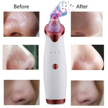 Load image into Gallery viewer, Blackhead Pore Remover Vacuum